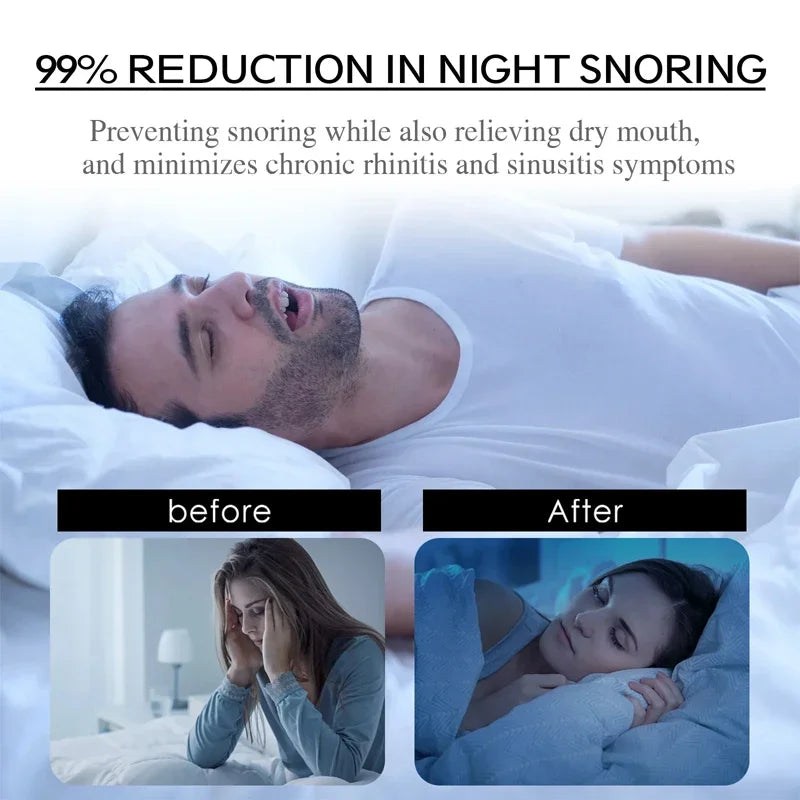 Anti Snoring Mouth Tape